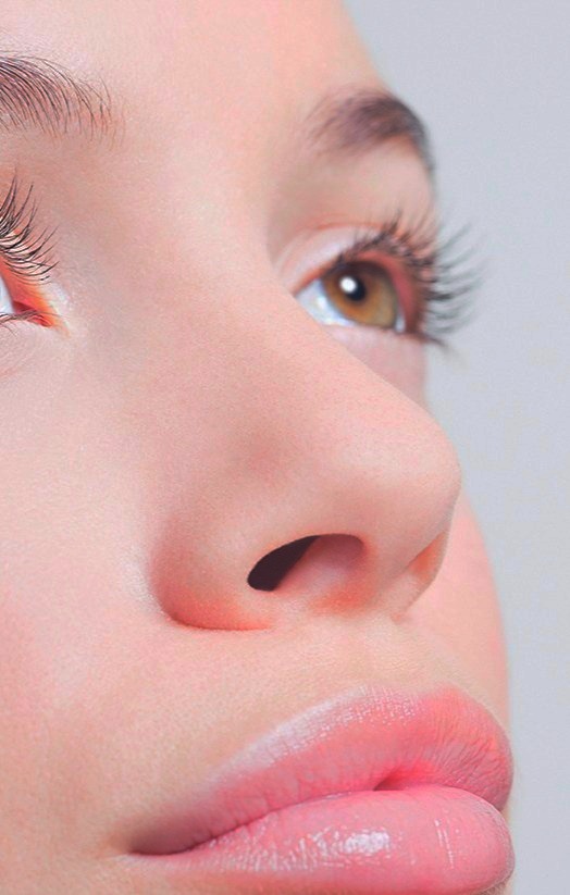 Rinoplastia
